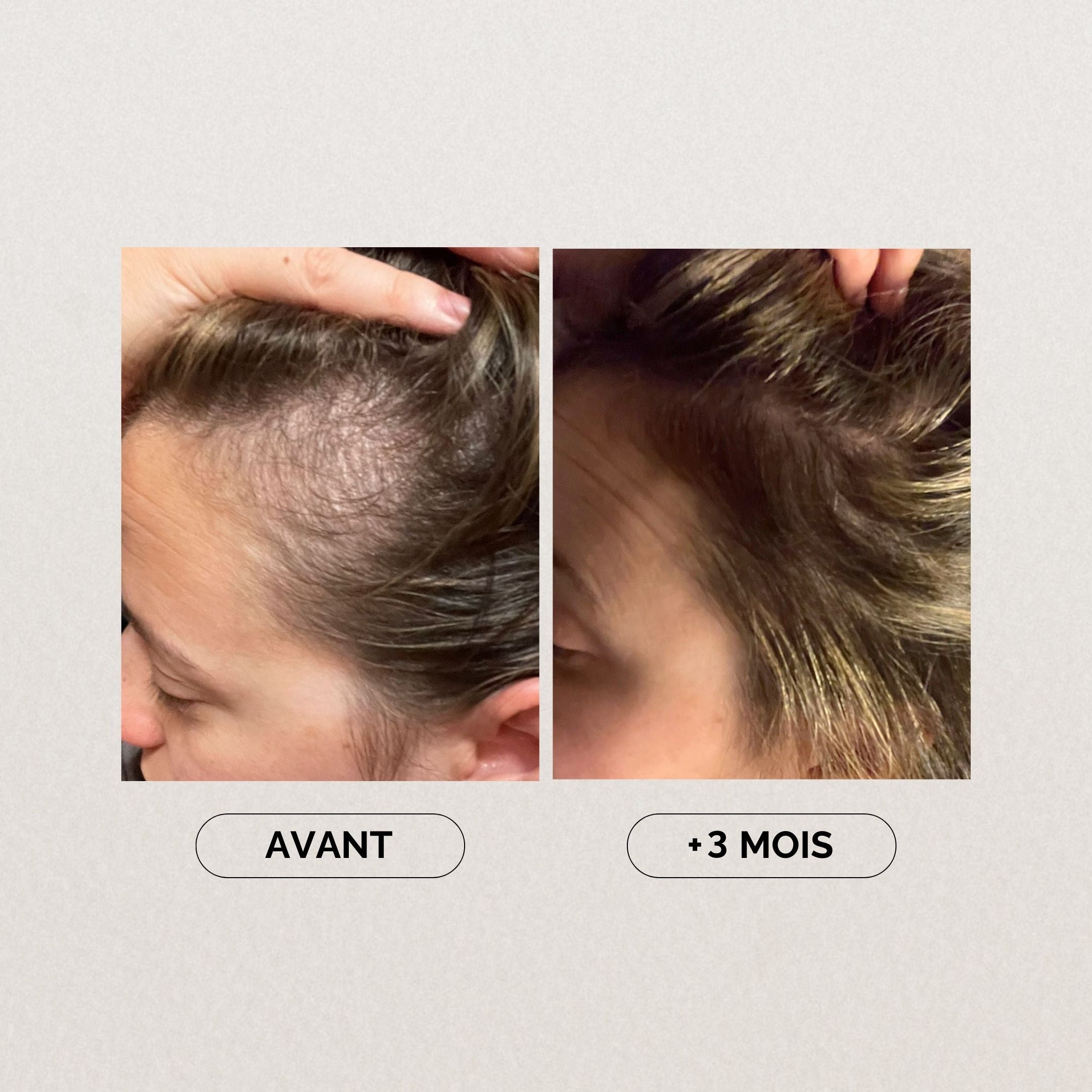 Paquete para piel y cabello