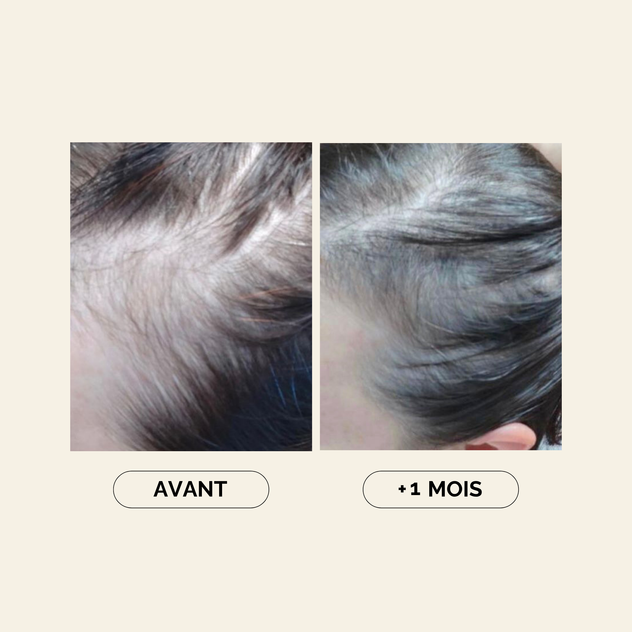 Baby Hair
