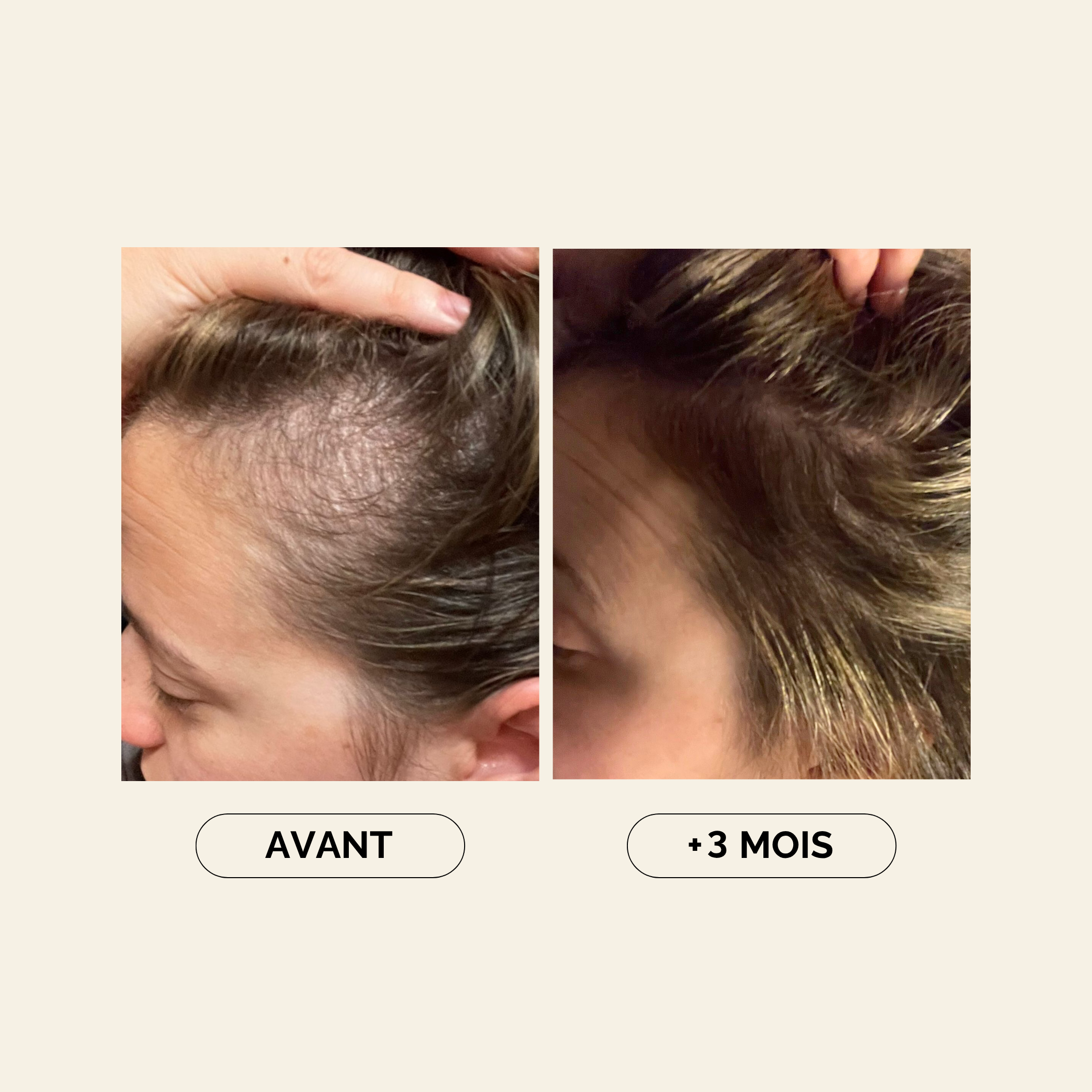 Avant Après 3 mois Baby Hair