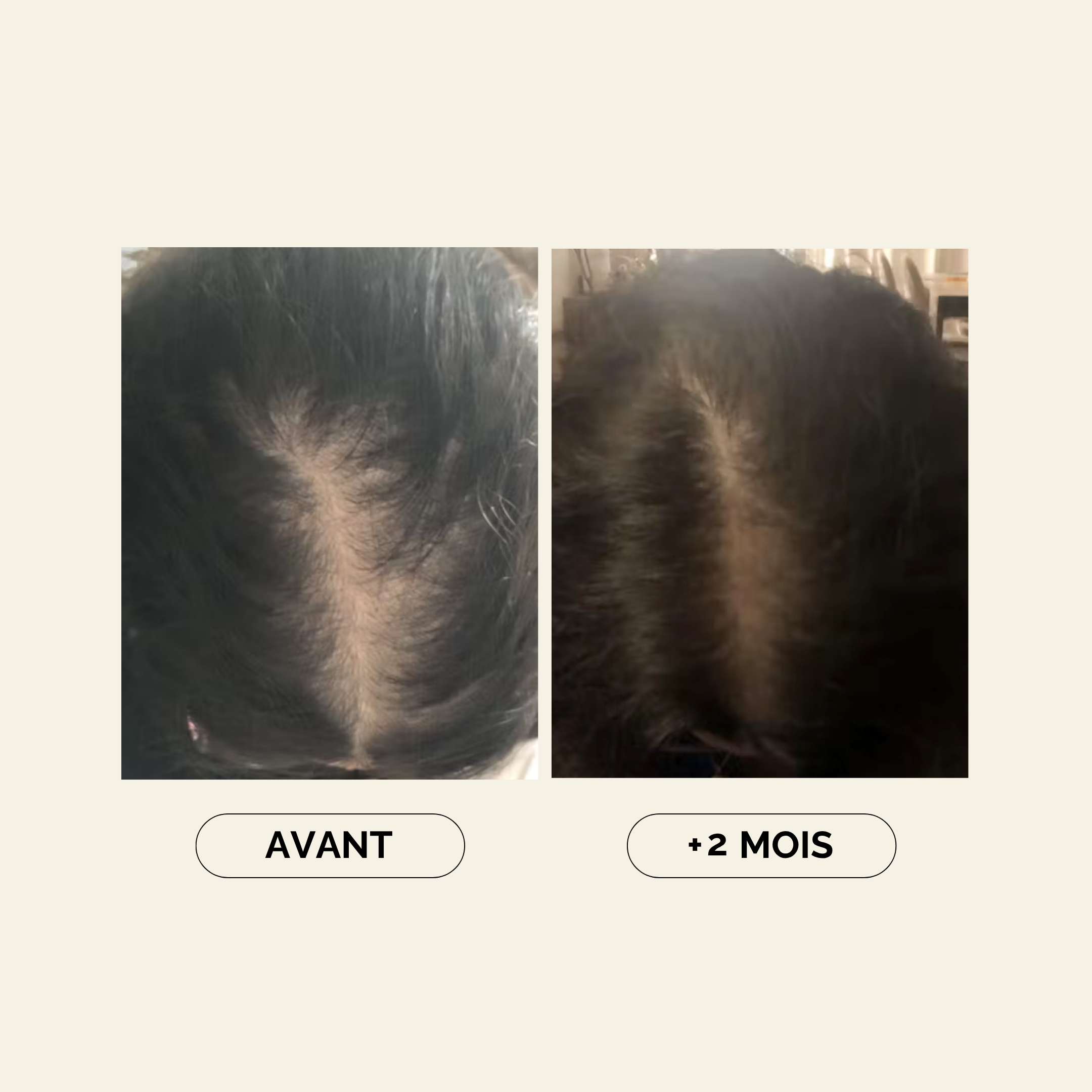 Baby Hair